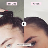 BondiBoost Intensive Growth Spray 125ml