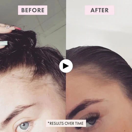 BondiBoost Intensive Growth Spray 125ml