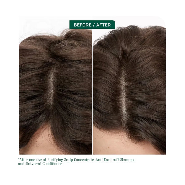 Matrix Biolage Scalp Sync Anti-Dandruff Shampoo & Universal Conditioner Duo