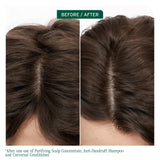 Matrix Biolage Scalp Sync Dandruff Prone Scalp Care Trio Bundle