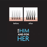 Santorini Hair Building Fibres Dark Brown 25g