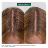 Matrix Biolage Scalp Sync Calming Shampoo & Universal Conditioner 1 Litre Duo